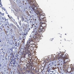 Anti-ARAP3 antibody produced in rabbit 