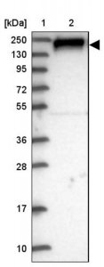 Anti-ARAP3 antibody produced in rabbit 