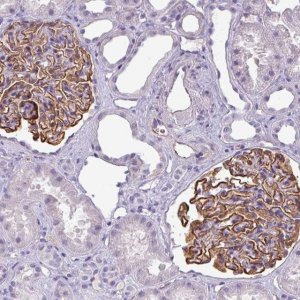 Anti-AREL1 antibody produced in rabbit 