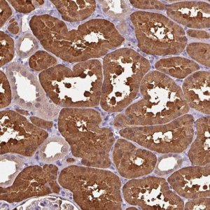 Anti-ARFIP1 antibody produced in rabbit 