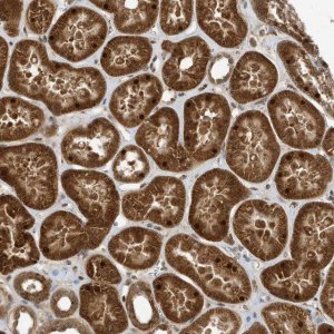 Anti-ARHGAP15 antibody produced in rabbit 