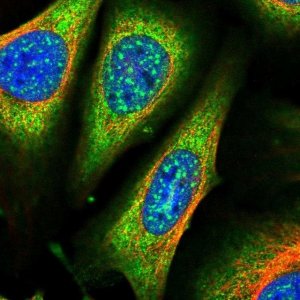 Anti-ARHGAP18 antibody produced in rabbit 