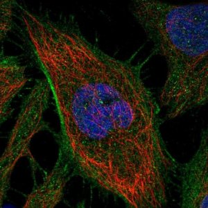 Anti-ARHGAP21 antibody produced in rabbit 