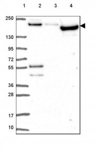 Anti-ARHGAP35 antibody produced in rabbit 