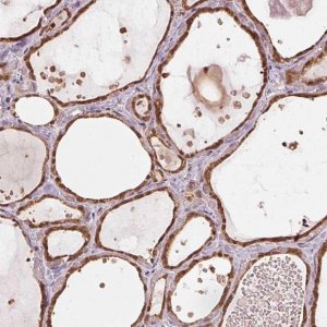Anti-ARHGAP6 antibody produced in rabbit 