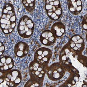Anti-ARHGEF16 antibody produced in rabbit 