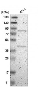Anti-ARHGEF16 antibody produced in rabbit 