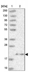 Anti-ARL8A antibody produced in rabbit HPA045924-100UL