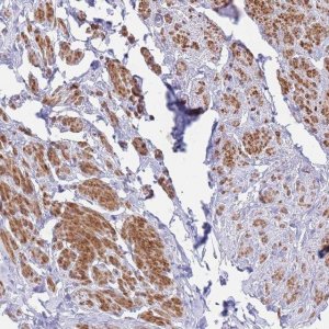Anti-ASAP3 antibody produced in rabbit 