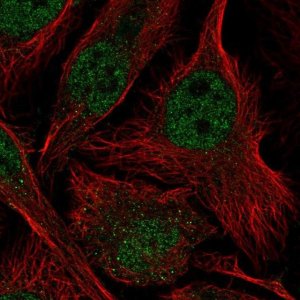 Anti-ASF1B antibody produced in rabbit 