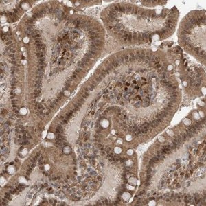 Anti-ATAD2B antibody produced in rabbit 