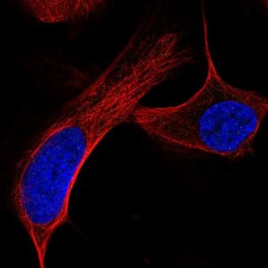 Anti-ATM antibody produced in rabbit 