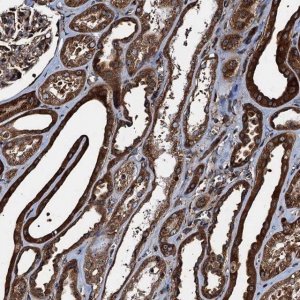 Anti-ATP2C1 antibody produced in rabbit 