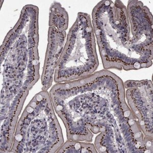 Anti-ATP6V1C2 antibody produced in rabbit 