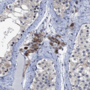 Anti-ATP7B antibody produced in rabbit 