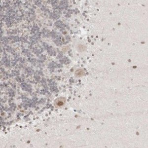 Anti-AUTS2 antibody produced in rabbit 