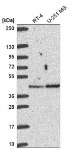 Anti-BABAM1 antibody produced in rabbit HPA054386-100UL