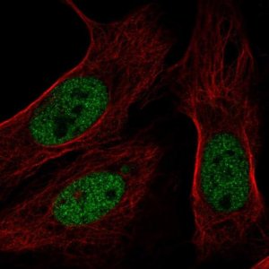 Anti-BAP1 antibody produced in rabbit 