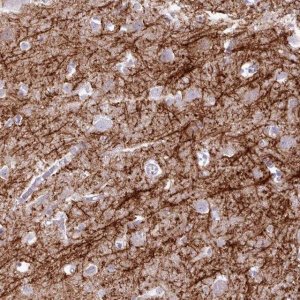 Anti-BDKRB2 antibody produced in rabbit 