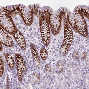 Anti-BDKRB2 antibody produced in rabbit 
