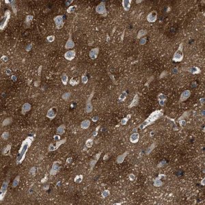Anti-BLOC1S1 antibody produced in rabbit 