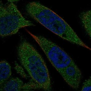 Anti-BLVRA antibody produced in rabbit 