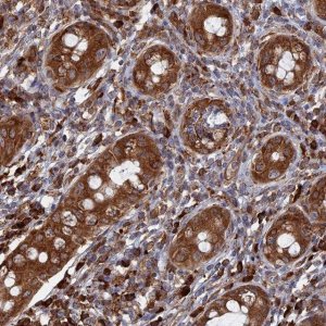 Anti-BPIFB6 antibody produced in rabbit 