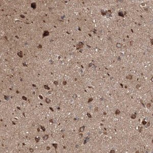 Anti-BRWD1 antibody produced in rabbit 