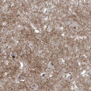Anti-BSN antibody produced in rabbit 