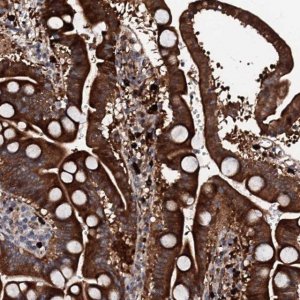 Anti-BTNL8 antibody produced in rabbit 