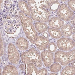 Anti-C10orf128 antibody produced in rabbit 