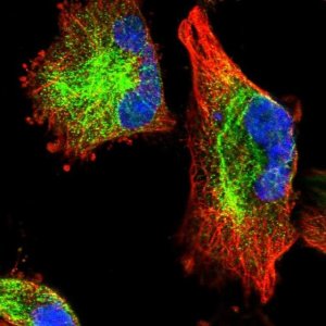 Anti-C11orf95 antibody produced in rabbit 