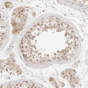 Anti-C17orf47 antibody produced in rabbit 