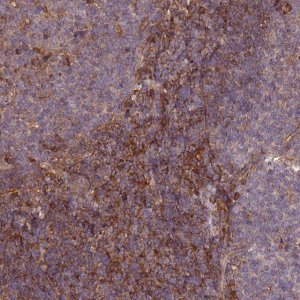 Anti-C17ORF62 antibody produced in rabbit 