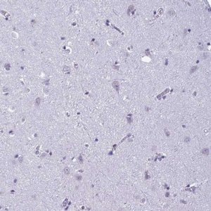 Anti-C1QL2 antibody produced in rabbit 