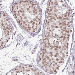 Anti-C22orf46 antibody produced in rabbit 