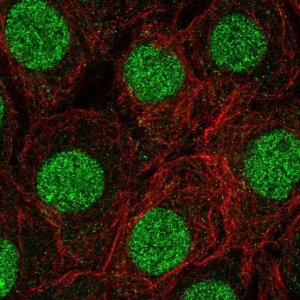 Anti-C22orf46 antibody produced in rabbit 