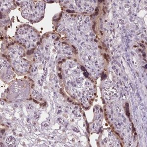 Anti-C2orf16 antibody produced in rabbit 