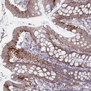 Anti-C3ORF36 antibody produced in rabbit 