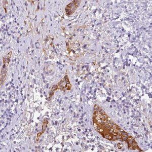Anti-C4A antibody produced in rabbit 