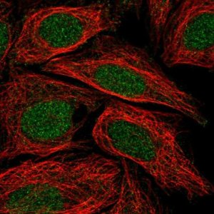 Anti-C5orf24 antibody produced in rabbit 