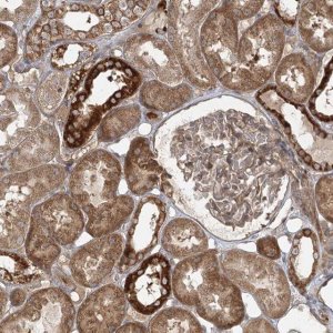 Anti-C5orf42 antibody produced in rabbit 