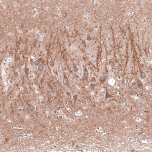 Anti-CACNA1H antibody produced in rabbit 