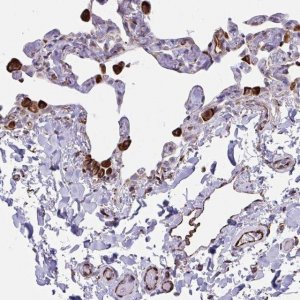 Anti-CACNG3 antibody produced in rabbit 