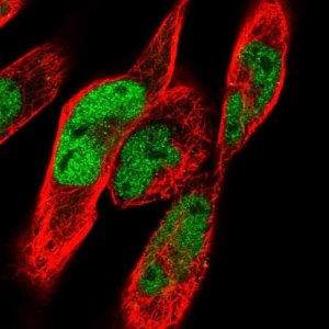 Anti-CACUL1 antibody produced in rabbit 