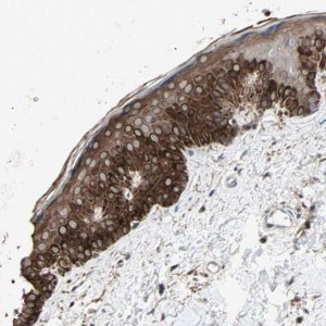 Anti-CALCRL antibody produced in rabbit 