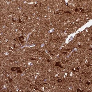Anti-CAMK2A antibody produced in rabbit 