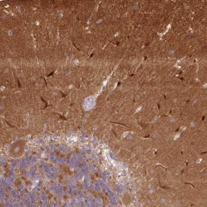 Anti-CAMK2A antibody produced in rabbit 
