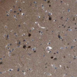 Anti-CAMK4 antibody produced in rabbit 