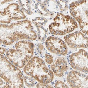 Anti-CAMK4 antibody produced in rabbit HPA011753-100UL